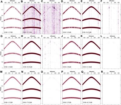 Intelligent reconstruction for spatially irregular seismic data by combining compressed sensing with deep learning